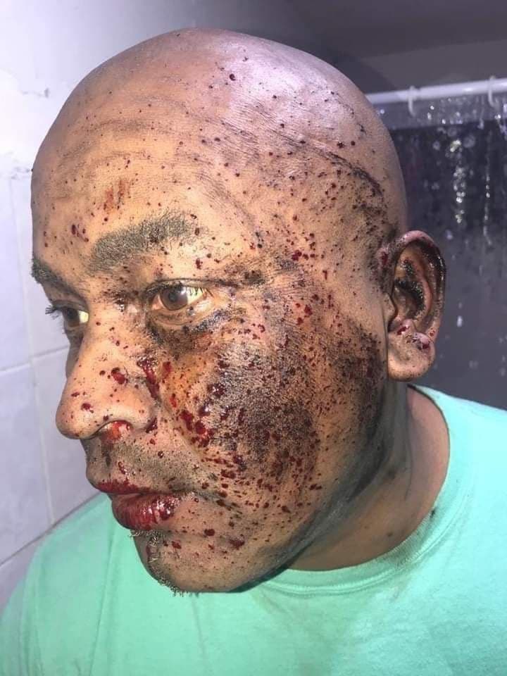 Un hombre sufrió un accidente luego de que prendió la mecha de un juego pirotécnico, pero éste le explotó en la cara, lo que quedó registrado en un video.