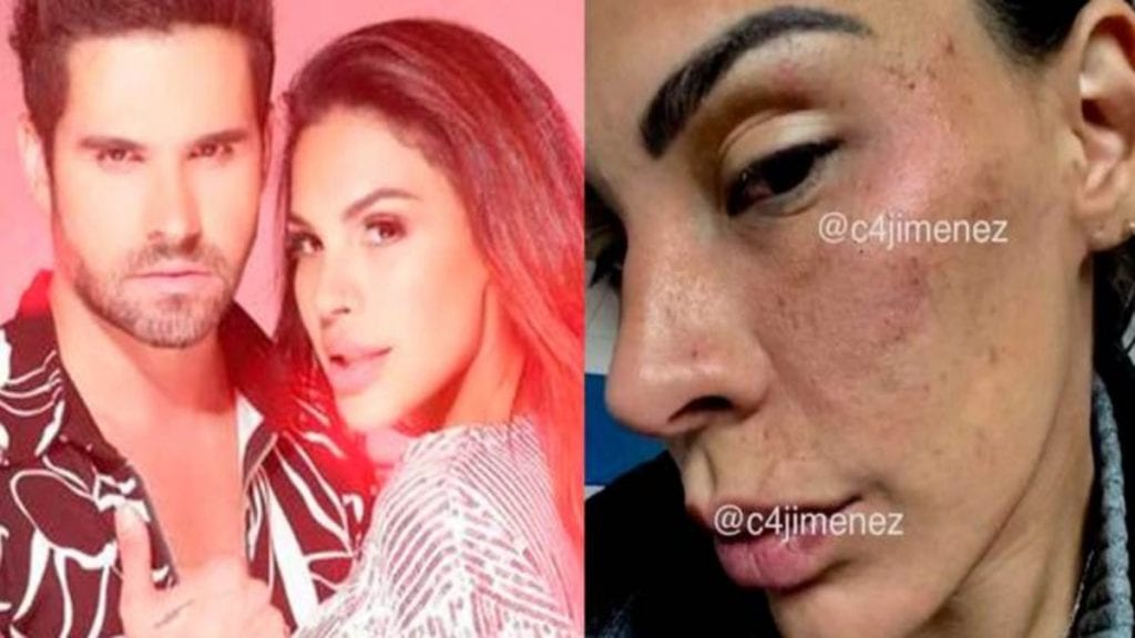 Eleazar Gómez aceptó su culpabilidad y consiguió liberta condicional por tres años, esto luego de ser acusado de violencia contra su entonces novia, la modelo peruana Stephanie Valenzuela.