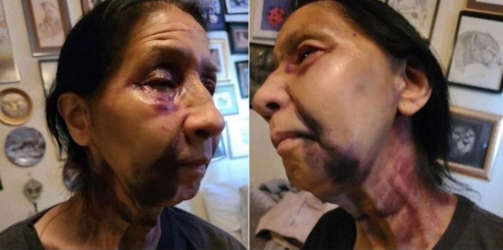 Una mexicana de 70 años de edad fue víctima de un crimen de odio en Los Ángeles, Estados Unidos, al ser confundida con una mujer de origen asiático y por ello fue brutalmente golpeada por una afroamericana.